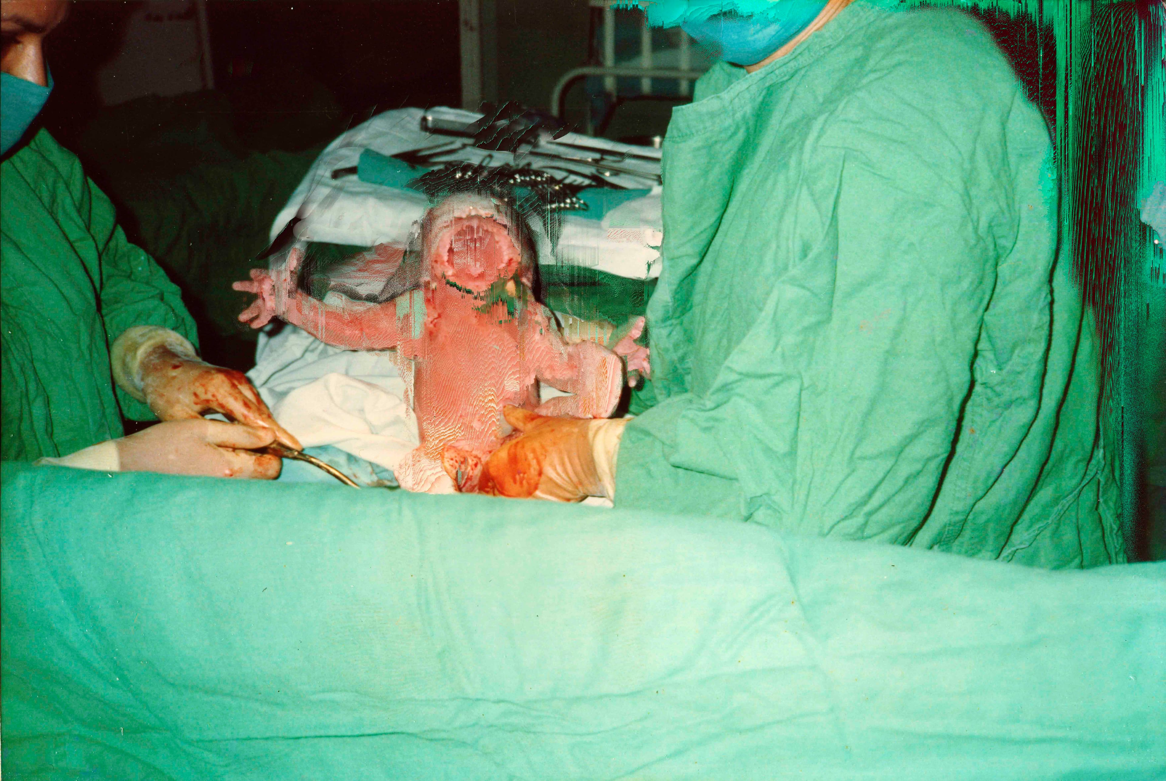 Archival image of the artist's birth, showing him as a baby being hold by nurses in green scrubs. The pixels are manipulated and appear to wipe out the baby's face© Cristóbal Ascencio Ramos