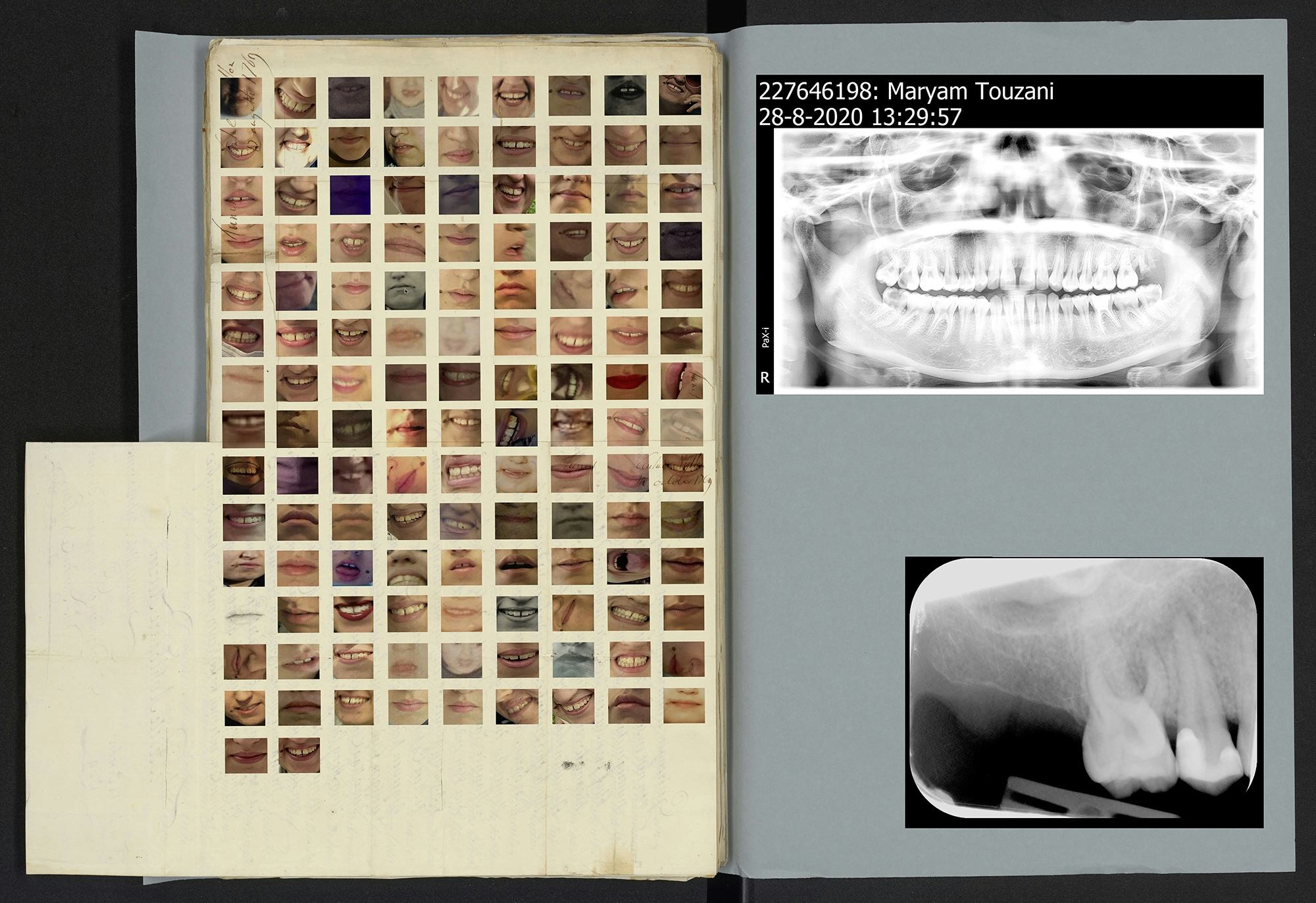 Image of a blue archive folder, showing tiny photos of smiles and an x-ray of the artist's teeth © MAryam Touzani
