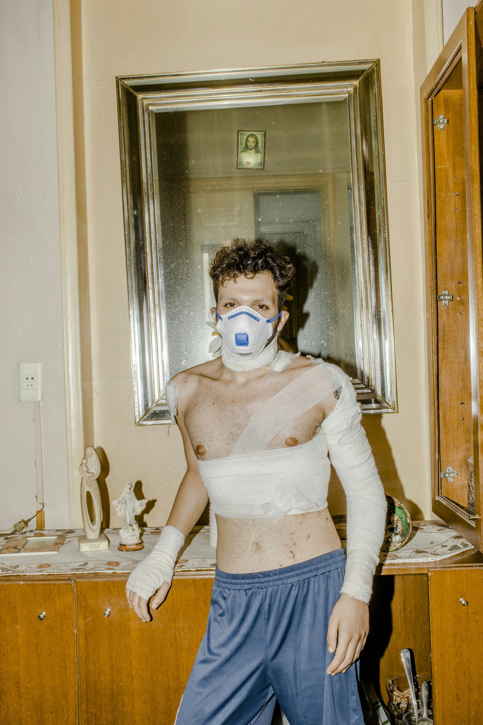 Photograph of a young injured man wearing a face mask, his arm, wrist and torso wrapped in bandages