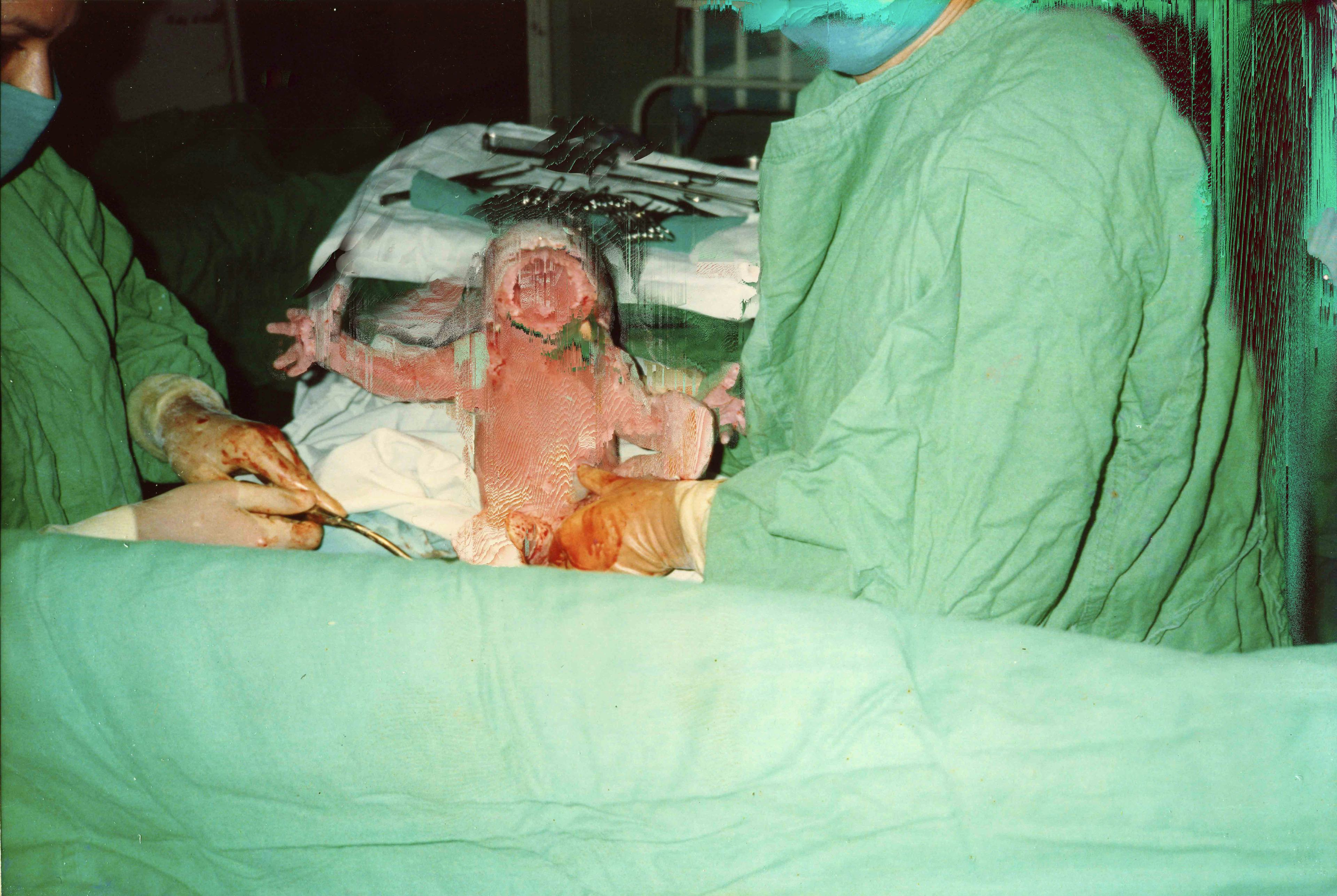 Archival image of the artist's birth, showing him as a baby being hold by nurses in green scrubs. The pixels are manipulated and appear to wipe out the baby's face© Cristóbal Ascencio Ramos
